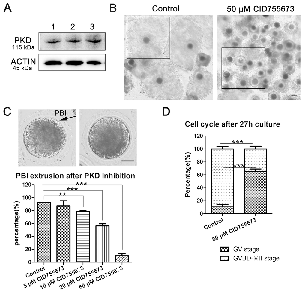 Effects of PKD inhibition on porcine oocyte maturation. (A) The expression of PKD in porcine oocytes. 1, 2, 3 indicates the samples of three replicates. Rabbit monoclonal anti-PKD antibody was adopted. (B) Representative images of cumulus expansion in the control and CID755673-treated groups. Black Crop indicated the status of cumulus expansion in porcine oocytes. Bar = 100 μm (C) Rate of oocytes which extruded the PBI in the control and CID755673 treatment groups, respectively. The rate of PBI extrusion was significantly decreased in 10 μM, 20 μM and 50 μM CID755673-exposed groups. Bar = 30 μm. (D) The proportions of cell cycle distribution were recorded in the control and CID755673 treatment groups. Data were expressed as mean percentage ± s.d. from at least three independent experiments. **, significant difference (P P 
