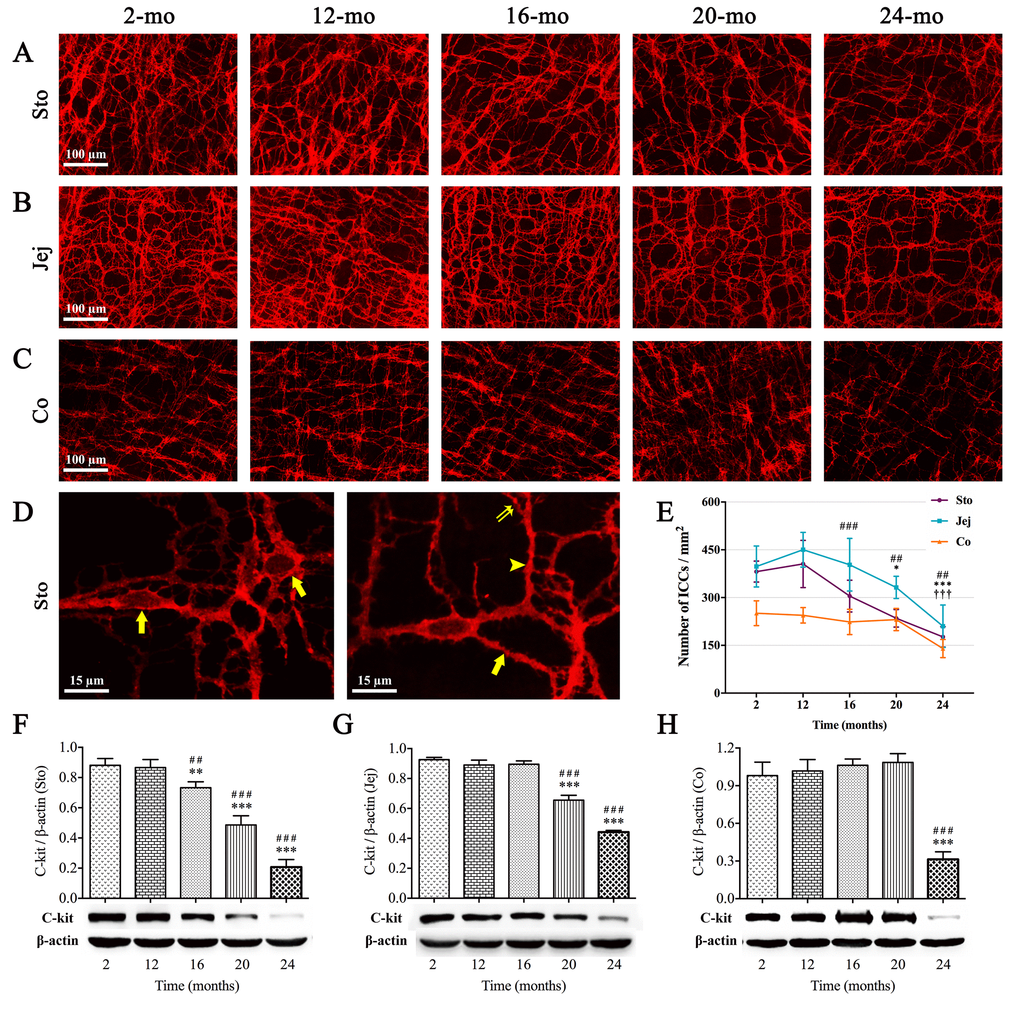 Influence of aging on ICCs in the mouse GI tract. The c-kit immunoreactivity (red) showed ICCs network in the whole-mount preparation. The sparseness of cellular network in stomach (A), jejunum (B) and colon (C) appeared at 16, 20 and 24 mo, respectively. In high magnification of 2-mo-old stomach (D), c-kit(+) cells with round or oval cell bodies (left figure, arrows) and cell processes (right figure) including primary (arrow), secondary (arrowhead) and tertiary processes (double arrow) were clearly seen by c-kit immunofluorescence staining. Statistical analysis showed that ICCs density decreased over time from 16 mo in stomach, 20 mo in jejunum and 24 mo in colon (E). Expressions of c-kit protein in 2-, 12-, 16-, 20- and 24-mo-old mice in different organs of GI tract were examined by western blotting (F-H). Densitometric analysis of protein expressions normalized to β-actin and the downtrend of c-kit expression was coincident with ICC-density in all three organs. Statistical analysis was performed using one-way analysis of variance and data were represented as mean ± SD, statistical significance is: (E) ## P P P P P F-H) ## P P P P 