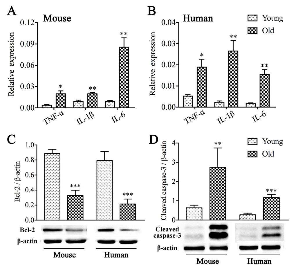 Inflammation and apoptosis in the muscle layer from aged colon. Both aged mice (A) and old people (B) exhibited elevated mRNA expression levels of classic pro-inflammatory cytokines including TNF-α, IL-1β and IL-6 compared with those from young. GAPDH was used as internal control. Reduced expression of Bcl-2 (C) and a rise in expression of cleaved caspase-3 (D) were revealed by western blot analysis. The densitometric analysis of protein expressions normalized to β-actin. Statistical analysis was performed using Student’s t-test and data were represented as mean ± SD, statistical significance is: * P P P 