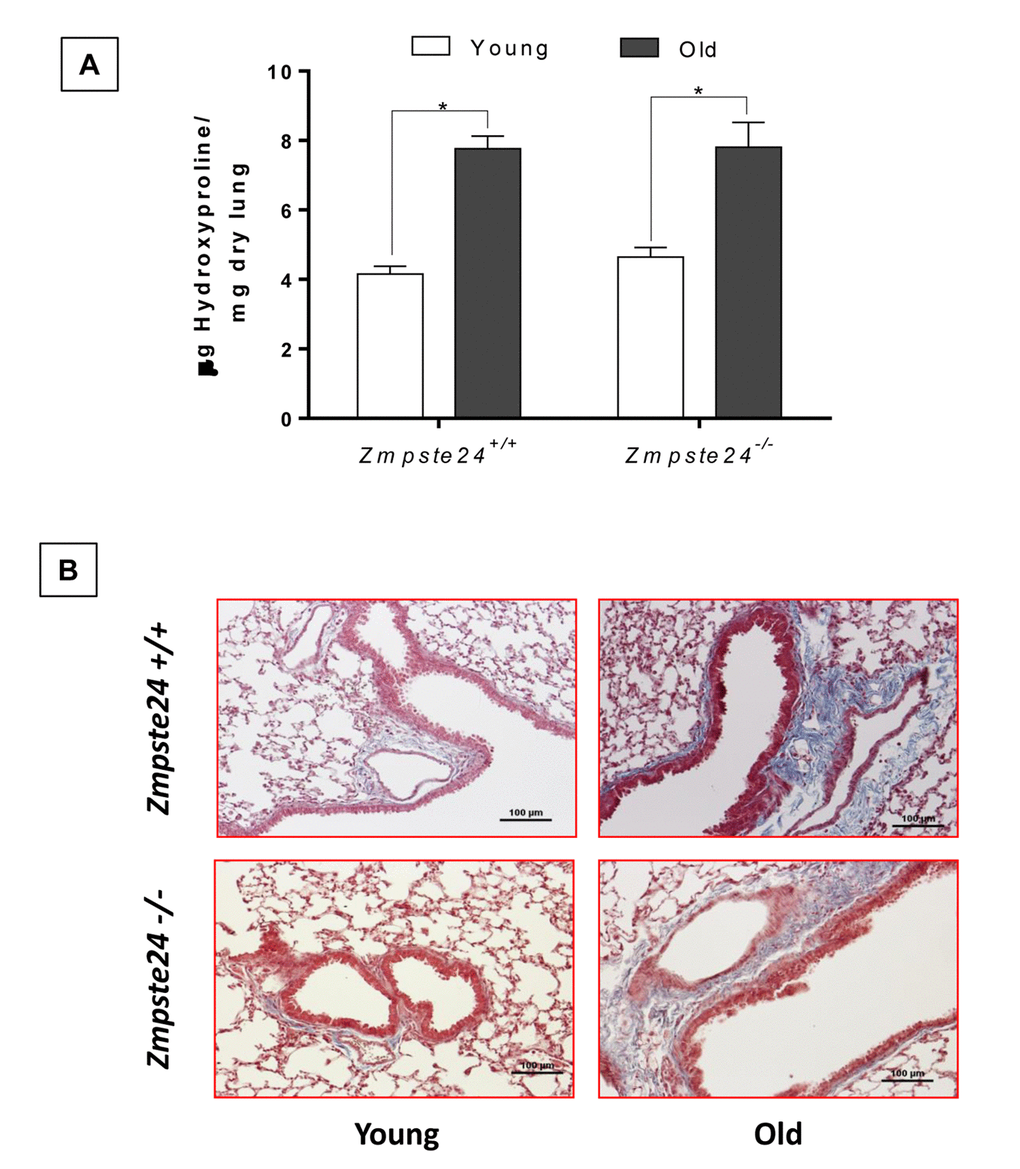 Aging increases lung collagen content in WT and Zmpste24-/- mice. (A) OH-Proline content. Data represent mean ± SD (n=4); *pB) Representative morphological images of two WT and two Zmpste24 deficient mice stained with Masson’s trichrome. Scale bar, 100 μm.