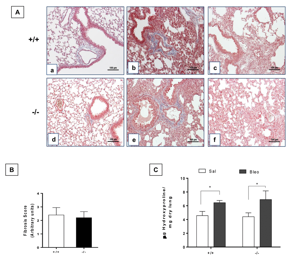Young WT and Zmpste24 deficient mice develop similar fibrotic response after bleomycin injury. (A) Representative Masson Trichrome staining of lung sections from young saline control WT (panel a), and 21 days after bleomycin (panels b, c), and Zmpste24 deficient mice saline control (panel d) and at 21 d after bleomycin (panels e, f). Scale bar, 100 μm. (B) Fibrosis score for grading lung histopathological changes. Graphs represent means ± SD. (C) OH-Proline content in lungs after saline or 21 days of bleomycin injury. *p