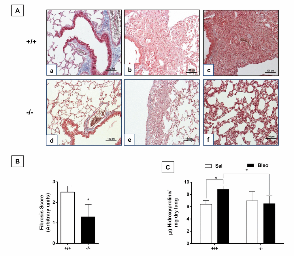 Aging protects Zmpste24 deficient mice from bleomycin-induced pulmonary fibrosis. (A) Representative Masson Trichrome staining of lung sections from old saline control WT (panel a), and 21 days after bleomycin (panels b, c), and Zmpste24 deficient mice saline control (panel d) and at 21 d after bleomycin (panels e, f). Scale bar, 100 μm. (B) Fibrosis score for grading lung histopathological changes. Graphs represent means ± SD. *pC) OH-Proline content in lungs after saline or 21 days of bleomycin injury. *pZmpste24 deficient mice (n=6).