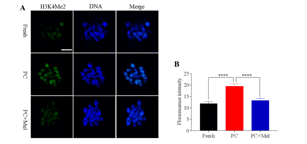 The effect of melatonin on histone methylation at H3K4me2 of prolonged-culture oocytes. Porcine oocytes matured in vitro were continuously cultured in medium supplemented with or without 10−3 M melatonin for 24 h. (A) Representative images of fresh, prolonged-culture and prolonged-culture + Mel oocytes stained with H3K4me2 antibody. (B) Quantitative analysis of H3K4me2 fluorescence intensity. The data are presented as mean ± SEM of at least three independent experiments. PC, prolonged-culture; Mel, melatonin; Scale bar=100 μm. Data are expressed as the mean ± SEM, ****P