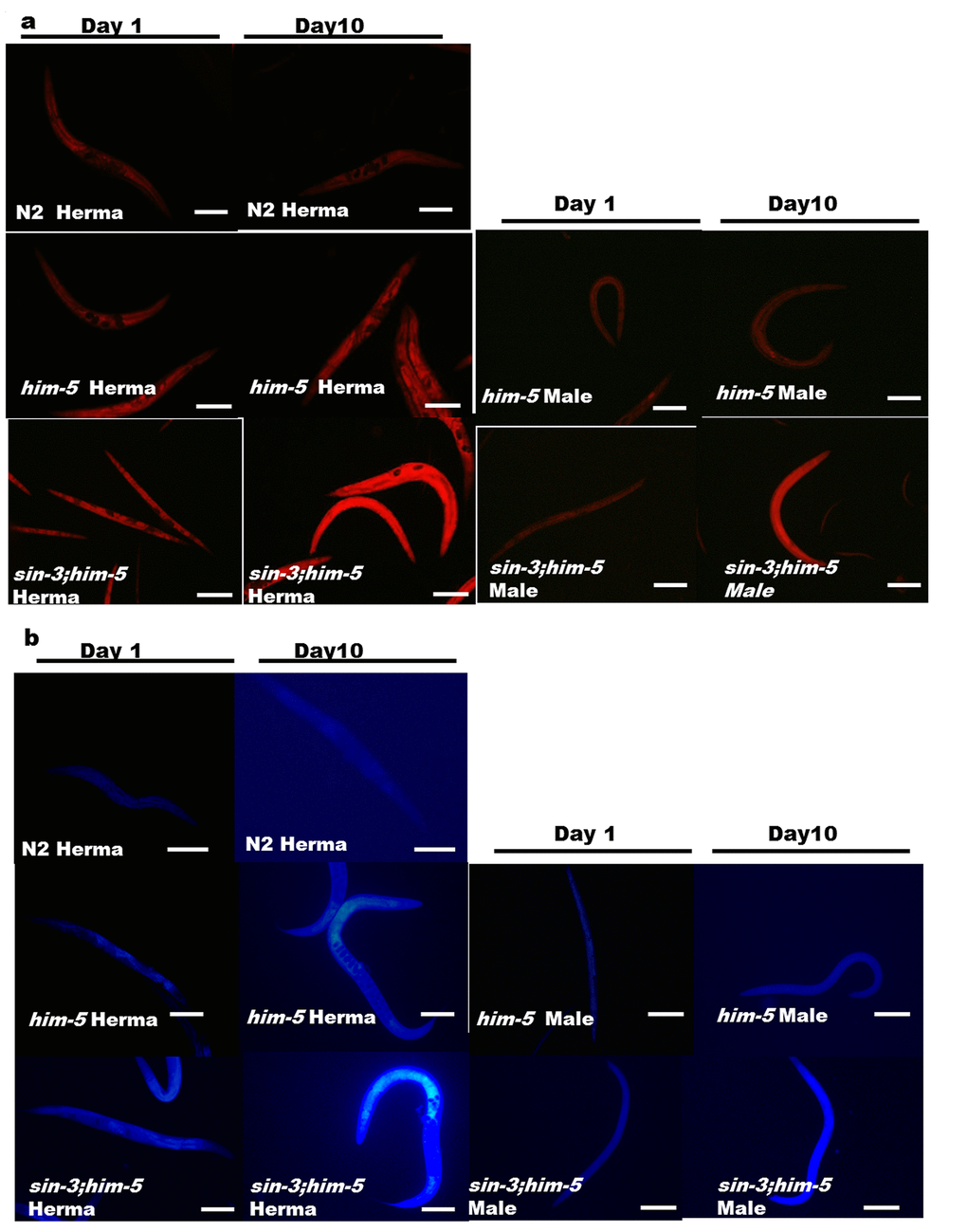 Enhanced age associated lipid and lipofuscin deposition in the sin-3;him-5mutants (a) sin-3;him-5 hermaphrodite and male as compared to worms from him-5(e1490) and wild-type N2 worms at day one and day ten of attaining adulthood. (b) Enhanced age associated death pigment lipofuscin was observed in the sin-3;him-5 hermaphrodite and male as compared to worms from him-5(e1490) and wild-type N2 worms at day one and day ten of attaining adulthood. Visualization was done using NIKON fluorescence microscope. Magnification 400X, scale: 500 µm. 30 worms per strain were visualized and the experiment was repeated thrice.