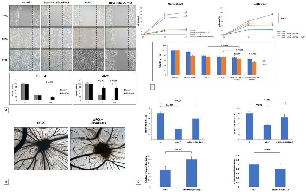 Wounded normal and tumor cell monolayers were photographed 24 and 48 hours after the mechanical scratch and the area of the wounds was measured in 3 independent wound sites per group. When specified, the cells were treated with small interfering RNA targeting NDUFA4L2 (siNDUFA4L2). RCC cells treated with siNDUFA4L2 have decreased cell migratory capabilities compared with untreated tumor cells (A). Chick embryo chorioallantoic membrane angiogenic assay: when tumor cell are treated with siNDUFA4L2, a lower vascular reaction is detectable (B). NDUFA4L2 has a role in RCC resistance to cisplatin (CDDP)-induced cytotoxicity (C). The death rate of treated tumor cells (tumor+ siNDUFA4L2+CDDP) is significantly higher than that of untreated cells (tumor+CDDP) (PC). RCC cells exhibit reduced levels of mitochondrial DNA, and produced lower levels of ATP, as compared to normal cells. These levels are rescued when cancer cells are treated with siNDUFA4L2 (D). NDUFA4L2 specifically inhibits mitochondrial complex I but not complex IV activity (D).