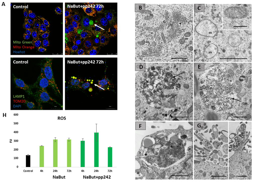 Senescent cells segregate damaged mitochondria into LC3-negative vacuoles after mTORC1 suppression. (A) IF images showing segregation of damaged mitochondria in the specific LC3-negative vacuoles in senescent cells exposed to mTOR inhibitor for 72 h. Upper panel: in vivo staining with Mitotracker Green and Mitotracker Orange visualized with the Leica TSC Microscope, 40x obj + zoom. Nuclei stained with Hoechst 33342. White arrow points the damaged mitochondria (Mitotracker Green only) inside of the vacuoles. Bottom panel: IF pictures after staining with antibodies against TOM20 and LAMP1 taken on the Olympus Fluoview 3000, 60x obj. Nuclei stained with DAPI. Arrow points the mitochondria colocalized with the lysosomes. (B) TEM image of senescent ERas cell with active mTORC1 (72 h) exhibiting the non-damaged mitochondria (m) and the enriched Golgi complex (G). (C) TEM image of senescent ERas cell treated with mTOR inhibitor pp242 for 72 h exhibiting the damaged mitochondria (m). Inset presents normal non-damaged mitochondria of untreated, non-senescent ERas cell. (D) Accumulation of membranous structures (mitochondria remnants, m) in the vacuole of senescent cell upon mTORC1 suppression. (E) Accumulation of lysosomes (Lys) in the vacuole of senescent cell upon mTOR suppression. (F) The vacuole containing lysosomes and membrane structure close to the plasma membrane of senescent ERas cell treated with mTOR inhibitor. (G) Membrane and electron-dense structures excreted from the cell. Scale bars in TEM images: 1 µm; inset (B) – 0,5 µm. (H) The level of reactive oxygen species (ROS) in senescent cells after 72 h of mTOR suppression measured using DCF-DA at proper wavelength.