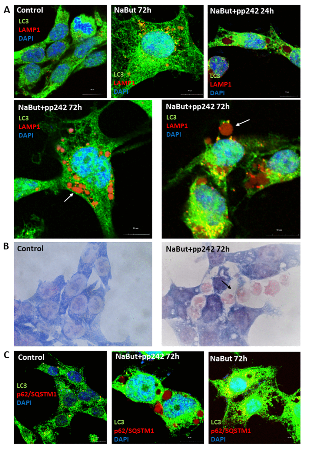 Senescent pp242-treated cells with disrupted autophagy form the LC3-negative cavities where lysosomes and p62/SQSTM1 accumulate. (A) IF analysis of LC3 and lysosome (LAMP1) localization in senescent cells and mTORC1- suppressed senescent cells. Arrows show LAMP1 clamps in the LC3-negative vacuole (left image) and outside of the cell (right image). Nuclei stained with DAPI. (B) Morphology of senescent cells after 72 h of mTORC1 inhibition. Arrow shows acidic clamps secreted from the cells. (C) P62/SQSTM1 accumulates in vacuoles of senescent cells exposed to pp242. Nuclei stained with DAPI.