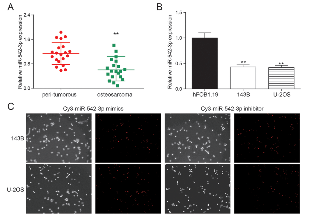 miR-542-3p was down-regulated in osteosarcoma tissues and cells. (A) The results of qRT-PCR showed that miR-542-3p was low expressed in osteosarcoma tissues. **PB) The expression of miR-542-3p in cell lines 143B and U-2OS were lower than that in normal human osteoblastic cell line hFOB1.19. **PC) The miR-542-3p mimics and inhibitor had high transfection efficiency.