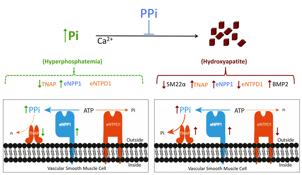 Extracellular pyrophosphate metabolism during phosphate-induced calcification. Extracellular pyrophosphate (PPi) is produced upon ATP hydrolysis by the enzyme ectonucleotide pyrophosphatase/phosphodiesterase 1 (eNPP1). Pyrophosphate is degraded to phosphate (Pi) by tissue-nonspecific alkaline phosphatase (TNAP). Ectonucleoside triphosphate diphosphohydrolase 1 (eNTPD1), hydrolyzes ATP (and ADP) to Pi. Figure shows changes in the extracellular pyrophosphate metabolism in response to high concentrations of Pi (before hydroxyapatite is formed) and in response to hydroxyapatite. Hydroxyapatite also increases the expression of bone morphogenetic protein 2 (BMP2) and reduces the expression of adult smooth muscle marker 22α (SM22α).