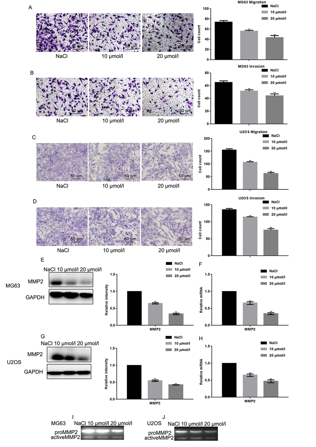 Naringin inhibits migration and invasion of osteosarcoma cells. (A-D) Migration and invasion were studied, respectively, using Transwell assays with or without Matrigel, in naringin-treated MG63 and U2OS cells. Cell count results represent the mean ± SD of three experiments. **P E-H) MMP2 expression by Werstern blot and real-time PCR in MG63 and U2OS cells treated with NaCl or naringin for 24 h. **P I, J) Zymography gel assay showing the inhibitory effect of naringin on MMP2 activity in MG63 and U2OS cells.