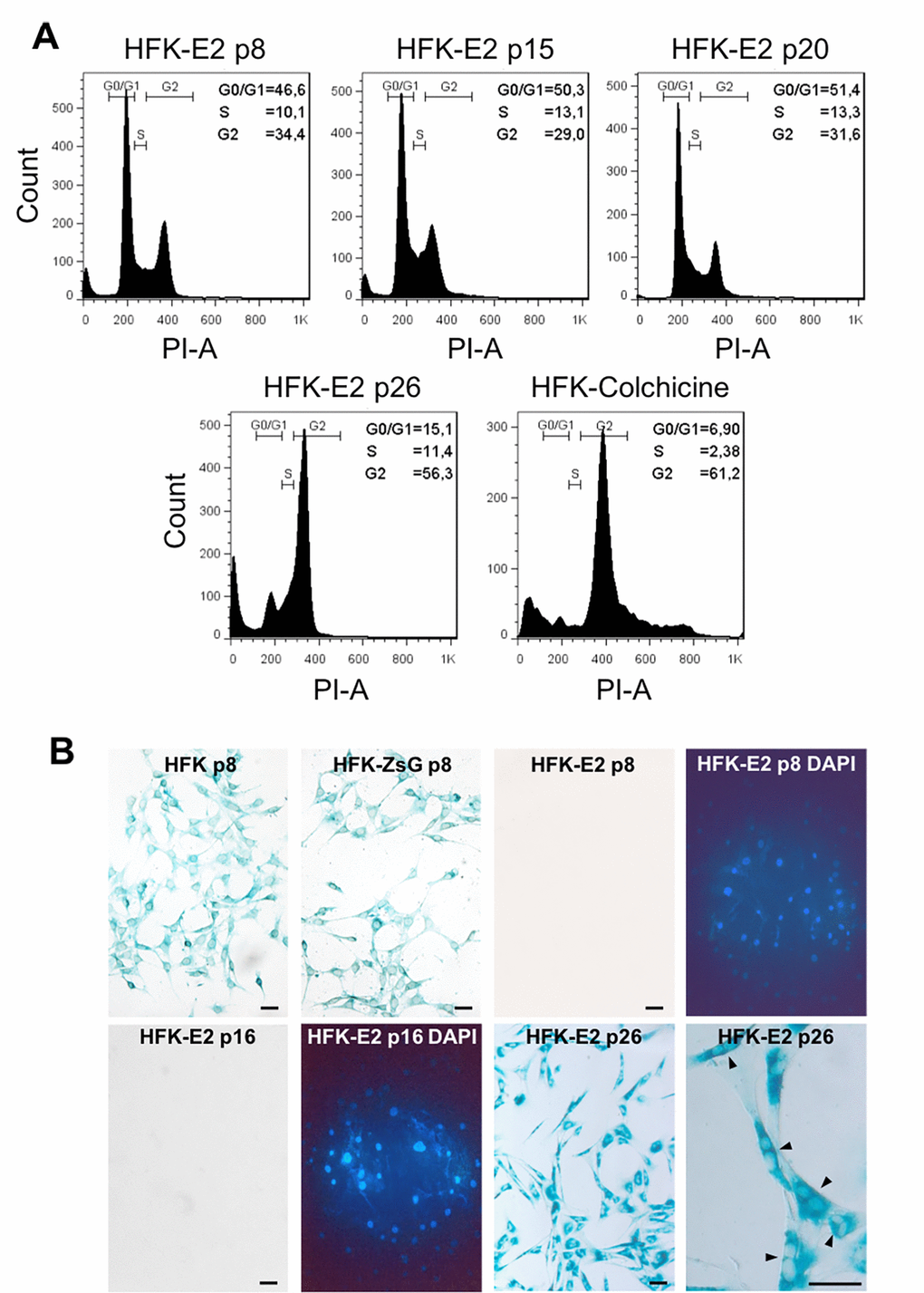 Spontaneous downregulation of E2 in HPV-18 E2-transduced cells induces replicative senescence. (A) Flow cytometric analysis of HFK-E2 cells at passages 8, 15 and 20 exhibited normal cell cycles with similar proportion of cells at G0/G1, S and G2/M phases. At p26, cells were arrested at G2/M, similar to HFK treated with 100 nM colchicine as positive control. (B) As shown before, HFK and HFK-ZsG at passage 8 were positive to SA-β-galactosidase activity, whereas HFK-E2 cells at p8 and p16 were negative to this senescence marker (DAPI stain is shown for both fields). At p26, HFK-E2 cells became positive for SA-β-galactosidase staining and a higher magnification shows many binucleated cells (arrowheads). Bars = 50 μm.