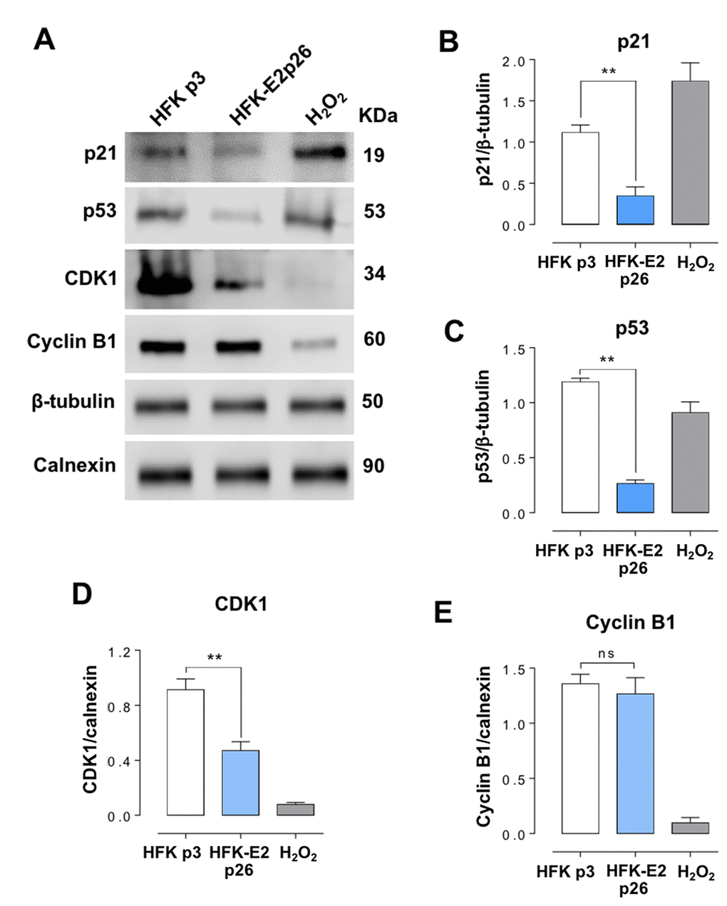 HFK-E2 cells at p26 inhibit the expression of p21. (A) Western blot of p21, p53, CDK1 and cyclin B1 in HFK at p3 and HFK-E2 at p26, using H2O2 as positive control of senescence. (B) A triplicate Western blot analysis confirms downregulation of p21 in HFK-E2 cells at p26 as compared to p3 HFK (**pC) The p53 protein, which is related to p21 expression, is also downregulated (**pD) (**pE) Cyclin B1 expression was not affected in HFK-E2 cells arrested at G2/M (ns). Of note, expression of both CDK1 and cyclin B1 is downregulated by treatment with H2O2. (**p