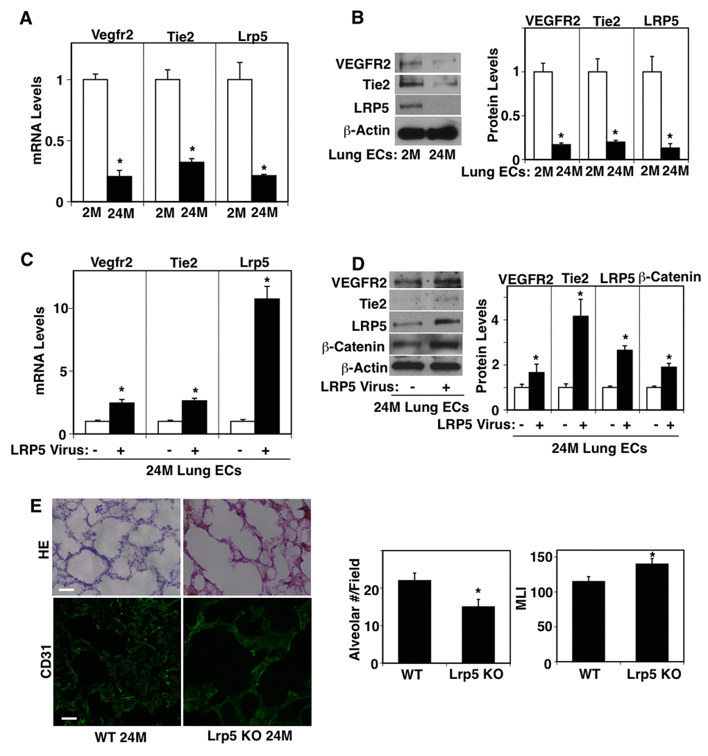 LRP5 mediates age-dependent changes in angiogenic factor receptor expression in mouse lung ECs. (A) Graph showing the mRNA levels of Vegfr2, Tie2, and Lrp5 in ECs isolated from 2M vs. 24M old mouse lungs (n=4, mean±s.e.m., *, pB) Representative immunoblots showing VEGFR2, Tie2, LRP5, and β-actin protein levels in ECs isolated from 2M vs. 24M old mouse lungs. Graph showing VEGFR2, Tie2, and LRP5 protein levels normalized by β-actin protein levels in ECs isolated from 2M vs. 24M old mouse lungs (n=4, mean±s.e.m., *, pC) Graph showing the mRNA levels of Vegfr2, Tie2, and Lrp5 in ECs isolated from 24M old mouse lungs treated with lentivirus overexpressing LRP5 (n=4, mean±s.e.m., *, pD) Representative immunoblots showing VEGFR2, Tie2, LRP5, β-catenin, and β-actin protein levels in ECs isolated from 24M old mouse lungs treated with lentivirus overexpressing LRP5. Graph showing VEGFR2, Tie2, LRP5, and β-catenin protein levels normalized by β-actin protein levels in ECs isolated from 24M old mouse lungs treated with lentivirus overexpressing LRP5 (n=4, mean±s.e.m., *, pE) H&E-stained 24M old WT and Lrp5 KO mouse lungs (top, scale bar, 50 μm). Immunofluorescence micrographs showing CD31-positive blood vessels in the 24M old WT and Lrp5 KO mouse lungs (bottom, scale bar, 20 μm). Graphs showing quantification of alveolar number (left) and alveolar size (MLI, right) in the 24M old WT and Lrp5 KO mouse lungs (n=4, mean ± s.e.m., *, p