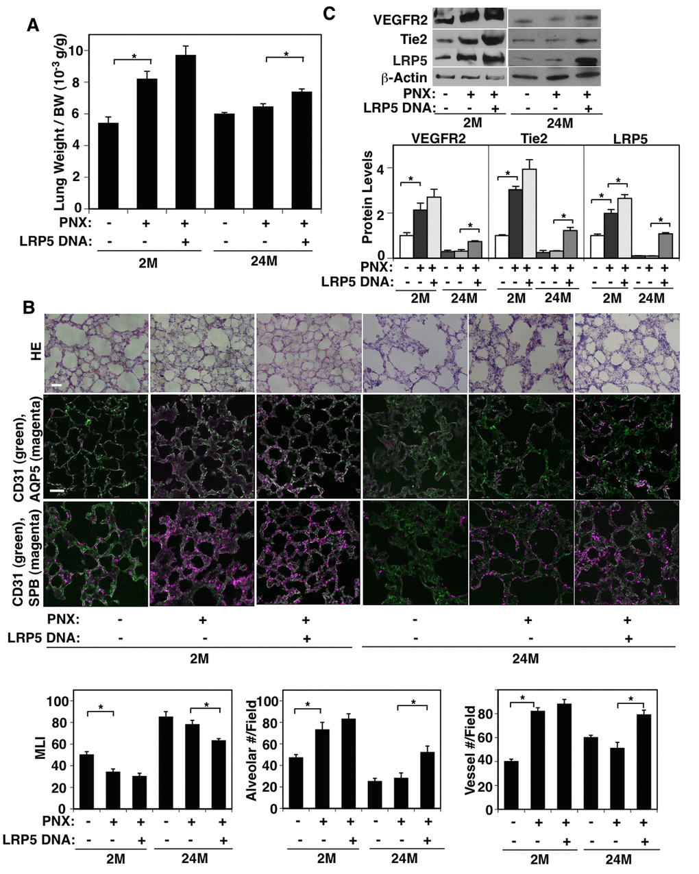 LRP5 mediates age-dependent inhibition of post-PNX compensatory lung growth. (A) Graph showing the ratio of the weight of right lung cardiac lobe to mouse BW in the 2M vs. 24M old mice after PNX or in combination with LRP5 overexpression for 7 days after PNX (n=7, mean ± s.e.m., *, pB) H&E-stained mouse lungs (top, scale bar, 20 μm), CD31-positive blood vessels and AQP5-positive alveolar type-I epithelial cells (middle, scale bar, 20 μm), and CD31-positive blood vessels and SPB-positive alveolar type-II epithelial cells (bottom) in the cardiac lobe of 2M vs. 24M old mice after PNX or in combination with LRP5 overexpression for 7 days after PNX. Graphs showing quantification of alveolar size (MLI, left), alveolar number (middle), and vessel number (right) in the cardiac lobe of 2M vs. 24M old mice after PNX or in combination with LRP5 overexpression for 7 days after PNX (n=7, mean ± s.e.m., *, pC) Representative immunoblots showing VEGFR2, Tie2, LRP5, and β-actin protein levels in the 2M vs. 24M old mouse lungs after PNX or in combination with LRP5 overexpression for 7 days after PNX. Graph showing the quantification of immunoblots (n=4, *, mean ± s.e.m., *, p