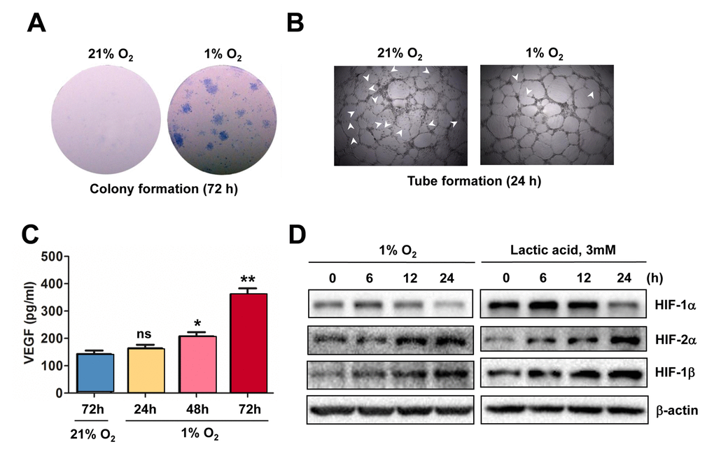 Hypoxia induces angiogenesis of ECs, in association with VEGF production and HIF activation. (A, B) HUVECs were cultured in ECGM medium containing 2% serum for the indicate intervals under either hypoxic (1% O2) or normoxic (21% O2) condition, after which cells were subjected to the following assays, including (A) colony formation assay (72 hrs) and (B) Matrigel-based tube formation assay (24 hrs). Representative microscopic images for at least three independent experiments were shown. Arrowheads indicate unclosed loops of vascular structure. (C) When HUVECs were cultured as described above under hypoxic (1% O2) or normoxic (21% O2) condition, medium was harvested at the indicated intervals and subjected to an ELISA assay to determine absolute amount of VEGF (pg/ml). Values represent the means ± SD for at least three independent experiments performed in triplicate. *P P 2); ns = not significant. (D) HUVECs were cultured under hypoxic (1% O2) condition (left panels) or exposed to the chemical hypoxia mimetic lactic acid (3 mM) for the indicated intervals (6 - 24 hrs), after which Western blot analysis was performed to monitor expression of HIF-1α, HIF-2α, and HIF-1β. Blots were reprobed for β−actin as loading control.