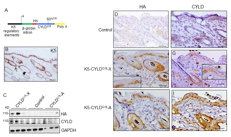 Analysis of the expression of the endogenous and the mutant CYLD protein in the K5-CYLDC/S mice. (A) Scheme of the construction used to obtain the K5-CYLDC/S mice. (B) Representative image showing the expression of K5 in the back skin of Control mice. Arrow: sebaceous gland; arrow head: ORS. (C) Analysis by WB of the expression of HA and CYLD in total protein extracts from the back skin of 30 day-old control and transgenic mice. Both lines of K5-CYLDC/S mice express higher levels of CYLD than Controls. HA was not detected in Control mice. GAPDH was used as a loading control. Immunostaining -with HA (D, F, H) and CYLD (E, G, I) antibodies- of back skin samples from Control (D, E) and transgenic (K5-CYLDC/S-X and K5-CYLDC/S-A) mice (F-G, H-I, respectively). HA is not expressed in Control mice (D). In the K5-CYLDC/S mice both, the expression of HA (F, H) and CYLD (G, I) follows the expression pattern of K5. Scale bars: 250μm (B); 150μm (D-I).