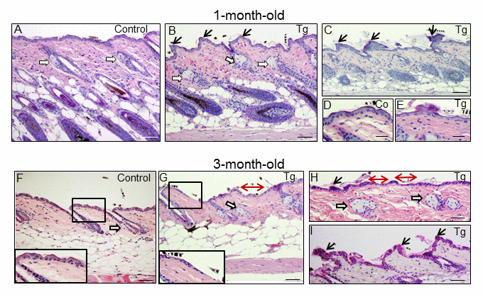 Histological alterations in the back skin of 1 and 3-month-old K5-CYLDC/S mice. (A-E) Histology of the back skin of 1-month-old Control (A, D) and K5-CYLDC/S mice (B, C, E). (A) Observe small sebaceous glands (white arrows) and HFs in the anagen phase in Control mice. (B, C) Note in transgenic mice the presence of moderately hyperplastic sebaceous glands, epidermal ridges and HFs initiating the anagen phase of the second hair growth cycle. (D, E) Slight thinning of the epidermis of K5-CYLDC/S mice. (F-I) Histology of the back skin of 3-month-old Control (F) and K5-CYLDC/S mice (G-I). (F) Note small sebaceous glands and telogenic HFs in Control mice. (G-I) Observe marked epidermal atrophy; abundant epidermal ridges of pyknotic keratinocytes, increased hyperplasia of the sebaceous glands and areas with orphan sebaceous glands lacking hair follicles in transgenic mice. White arrows: sebaceous glands; black arrows: epidermal ridges of pyknotic keratinocytes; double-headed red arrows: areas of epidermal atrophy. Scale bars: 250 μm (C, F-H); 200 μm (A, B); 180 μm (I); 150 μm (D, E).