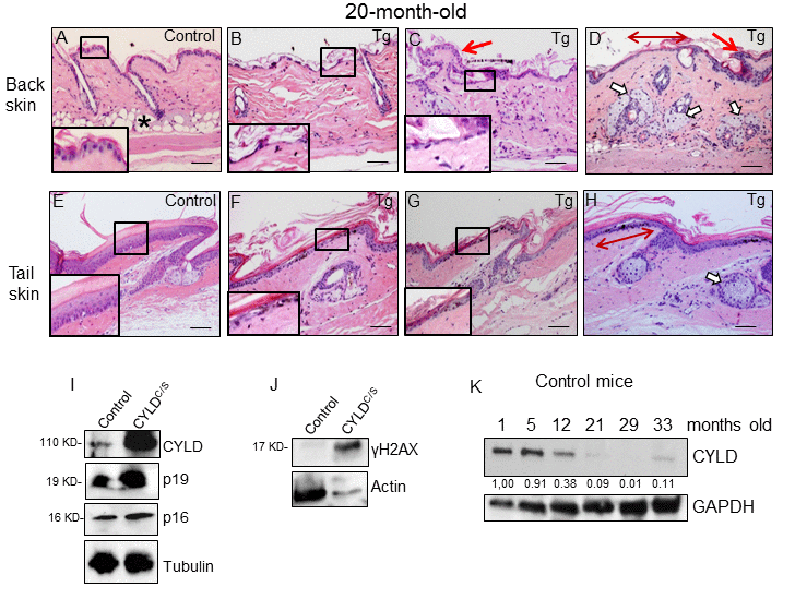 Histological and molecular signs of premature aging in the back skin of transgenic mice. (A-H) Representative histological images showing the back skin of 20-month-old Control mice (A) and the severe aging phenotype of the back skin of 20-month-old transgenic mice (B-D). (B-D) Note severe epidermal atrophy (compare insets in A with those of B and C; double-headed red arrow in D); foci of papillomatous hyperplasia (red arrows in C and D); numerous hyperplastic sebaceous glands, most of them orphan and grouped in the dermis (D); reduced number of HFs, and scarce or even lack of adipose tissue (compare A with B-D) in the back skin of the K5-CYLDC/S mice. (E-H) Tail skin of Control (E) and transgenic (F-H) mice. Note the presence of hyperplastic sebaceous glands and extensive epidermal atrophy (compare inset in E with those in F and G) in the tail of the K5-CYLDC/S mice. (I, J) WB of total protein extracts from skin of 12-month-old (I) and 6-month-old (J) showing elevated levels of p16, p19 and γH2AX in the K5-CYLDC/S mice. Tubulin and Actin are used as control loading. (K) WB of total protein extracts from the skin of Control mice from 1 to 33 months of age showing the decreased expression of CYLD as mice age. GAPDH is used as a control loading. White arrows: sebaceous glands; red arrows: papillomatous hyperplasia; double-headed red arrows: areas of epidermal atrophy. Scale bars: 250 μm (A-D); 200 μm (E-H).
