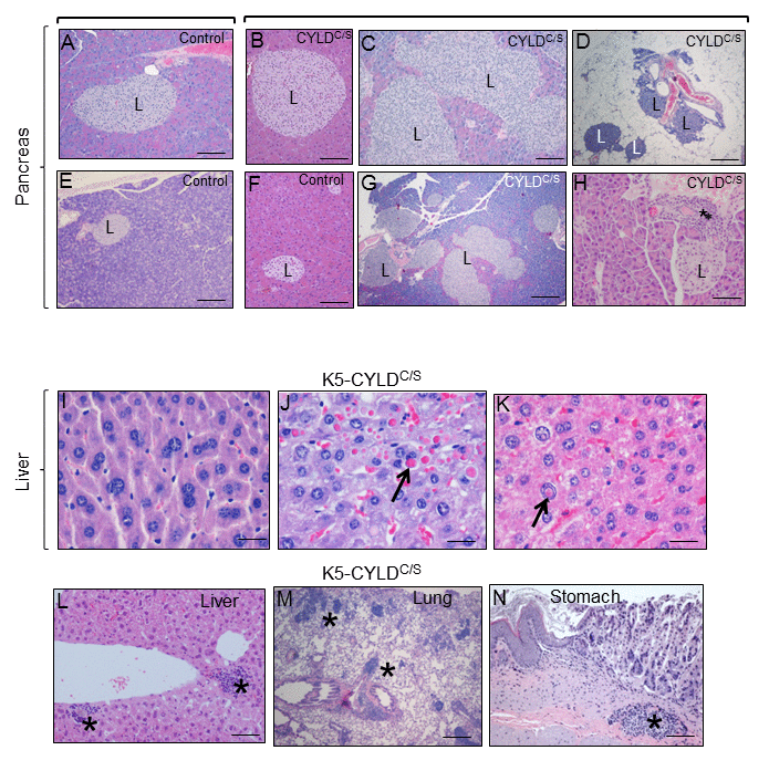 Alterations found in the pancreas, liver, lung and stomach of the K5-CYLDC/S mice suggestive of early aging of the K5-CYLDC/S mice. (A-H) Histopathologic analysis by H&E staining of pancreas from 5-month-old (B, F) and 12-month-old Control and transgenic mice. (A, E, F) Pancreas from Control mice: note the presence of Islets of Langerhans (L) of heterogeneous but moderate size. (B-D; G, H) Histology sections representatives of pancreas from K5-CYLDC/S mice. Note the hyperplasia of the Islets of Langerhans (B, C, G, H). (D) Extrapancreatic location of the Islets of Langerhans, in the peripancreatic fat, observed in the K5-CYLDC/S mice. (H) Foci of inflammation (asterisk) in the pancreas of K5-CYLDC/S mice. (I-N) Histopathological analysis of liver, lung and stomach sections from different organs of 20-month-old K5-CYLDC/S mice. (I-K) Representative images showing anisokariosis (I), eosinophilic intracytoplasmic inclusions (arrow in J), intranuclear eosinophilic inclusions (arrow in K), and inflammation foci (asterisks in L) in the liver. (M) Example of inflammation foci observed in the lung. (N) Stomach with an inflammation focus. The pancreas of 4 Control and 4 transgenic mice of 5- and 12-month-old were analyzed. Number of animals whose liver, lung and stomach has been analyzed is showed in Table 1. Asterisks: Inflammation. Scale bars: 250 μm (A, B, D-F); 350 μm (C); 500 μm (G); 150 μm (H; L-N); 40 μm (I-K).