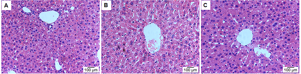 Effect of leonurine treatment on liver histopathological alterations. (A) Control group; (B) Model group; (C) Leonurine group. H&E staining, magnification 200×.
