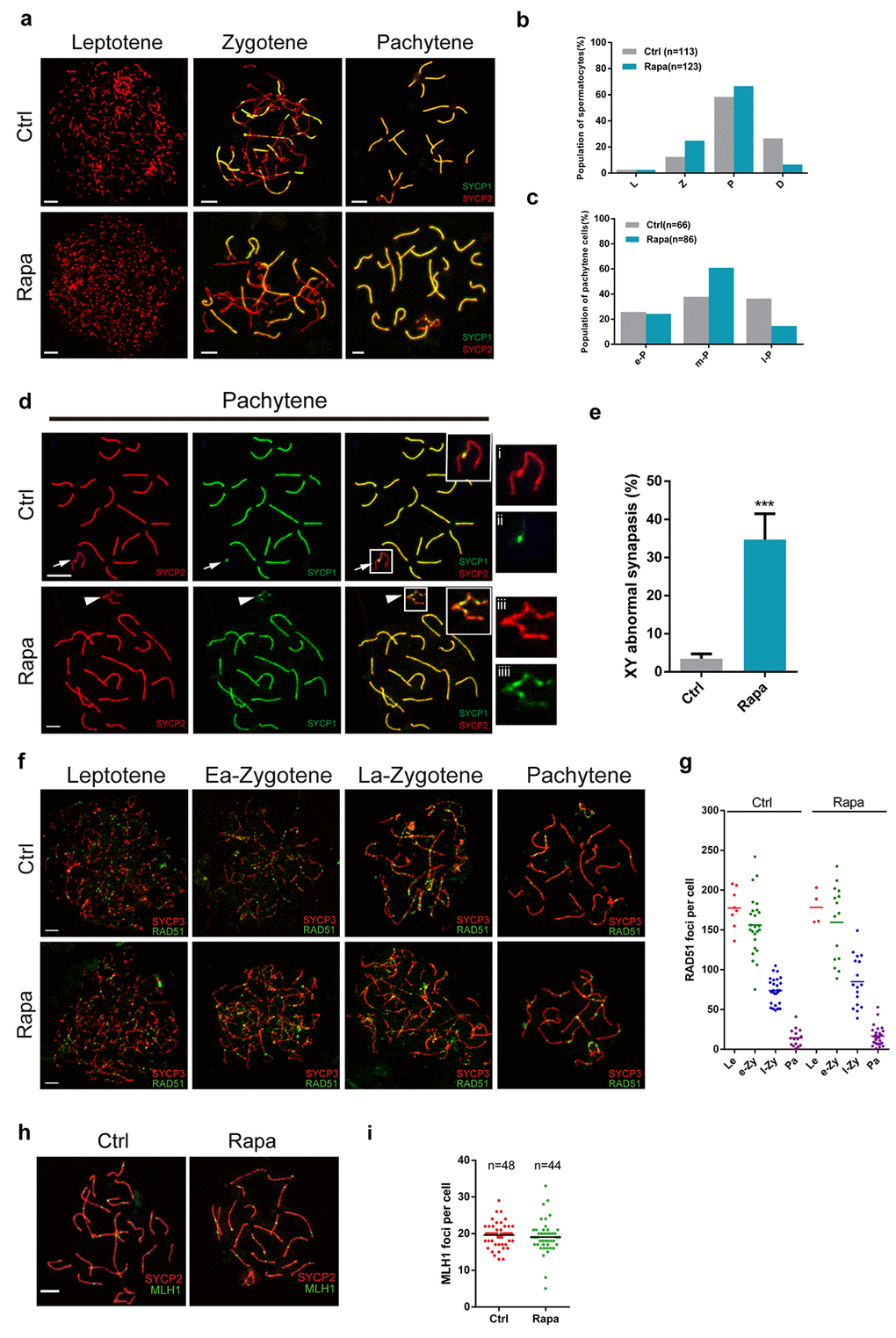 Meiotic defects in rapamycin-treated spermatocytes. Immunostaining of spread nuclei of spermatocytes for the synaptonemal complex proteins SYCP3 (red) and SYCP1 (green) or recombination proteins (green). (a) Identification of leptotene, zygotene and pachytene spermatocytes by SYCP1 and SYCP3 immunostaining. (b) Proportion of meiotic spermatocyte populations in control and rapamycin-treated mice. Leptotene (L), zygotene (Z), pachytene (P) and diplotene (D). (c) Percentage of e-P (early pachytene), m-P (middle pachytene) and l-P (late pachytene) spermatocytes. (d, e) Significantly increased frequency of abnormal localization of SYCP1 to the sex chromosomes in pachytene stage spermatocytes. White arrows and white arrowheads mark the sex chromosomes in control and rapamycin-treated spermatocytes, respectively. (f, g) Immunostaining for RAD51 (green) and SYCP3 (red) in leptotene, early zygotene (Ea-Zygotene), late zygotene (La-Zygotene) and pachytene stage spermatocytes identifies similar numbers of RAD51 foci per cell in spermatocytes from control and rapamycin-treated mice. (h) Similar numbers of MLH1 foci per cell in control and rapamycin-treated spermatocytes based on MLH1 (green) and SYCP3 (red) immunostaining. Error bars represent SD (*P 