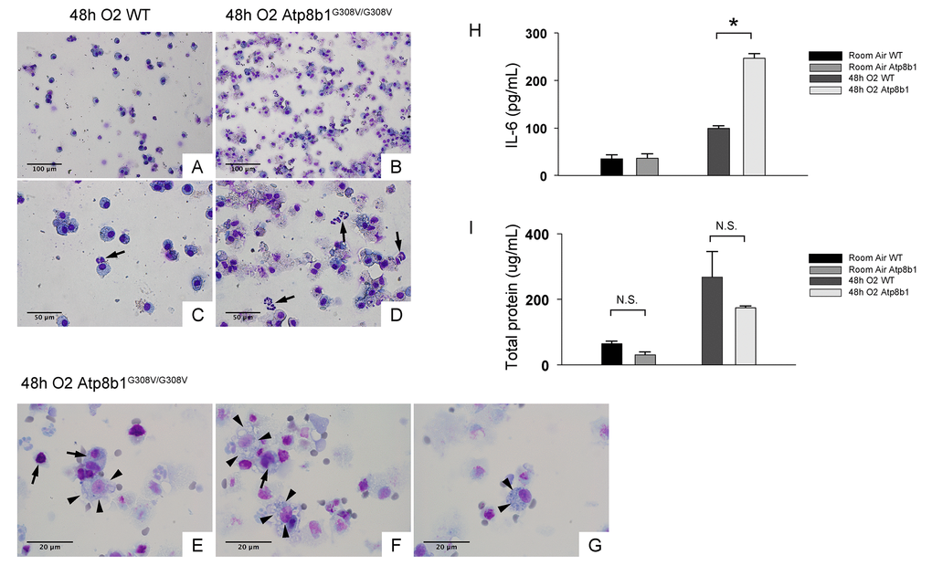 Atp8b1G308V/G308V mice under hyperoxic conditions display increased number of total cells in airspace compared to WT controls. Representative photomicrographs of bronchoalveolar lavage fluid (BAL) cells retrieved from WT (A & C) and Atp8b1G308V/G308V mice (n=3 for each) (B, D & E-G) following exposure to 100% O2 for 48 hrs. BAL fluid (BALF) cells were stained with Diff-Quik. Infiltrating neutrophils are indicated by arrows in Panel C & D. Highly vacuolated cells with weakly stained nucleus are encountered in airspace of hyperoxic Atp8b1G308V/G308V mice (arrowheads in Panel E & F), which are morphologically distinct from surrounding cells that are considered to be macrophages (arrows in Panel E & F). Cells with eccentric nucleus and numerous cytoplasmic granules are occasionally encountered in hyperoxic Atp8b1G308V/G308V mice, which are not morphologically similar to any immune cell types that are normally encountered in lung airspace (cell designated by arrowheads in Panel G). (H & I) Levels of IL-6 and total protein in BALF from WT and Atp8b1G308V/G308V mice exposed to normoxia or 100% O2 for 48 hrs. IL-6 levels in BALF were measured by ELISA (n=3 for each group). Results are presented as Means ± SE. *p 