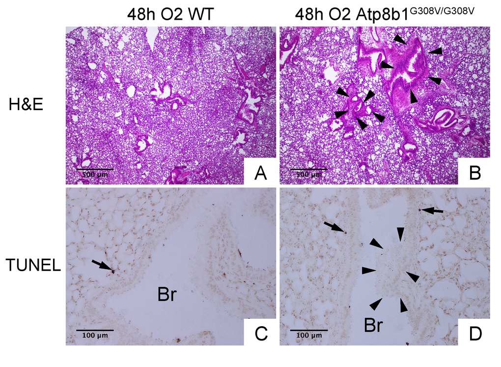 Atp8b1G308V/G308V mice under hyperoxic conditions display patchy thickening of bronchiolar epithelium with epithelial hypercellularity. (A & B) Photomicrographs of H&E stained lung sections from WT and Atp8b1G308V/G308V mice exposed to 100% O2 for 48 hrs (n=3 for each). (C & D) Photomicrographs of TUNEL stained lung sections from WT and Atp8b1G308V/G308V mice exposed to 100% O2 for 48 hrs. Arrowheads denote thickened bronchiolar epithelium of hyperoxic Atp8b1G308V/G308V lungs. TUNEL positive cells are denoted by arrows. Br: Bronchiolar lumen. Magnifications: (A & B) 100X; (C & D) 200X. Data presented are representative of two independent experiments.