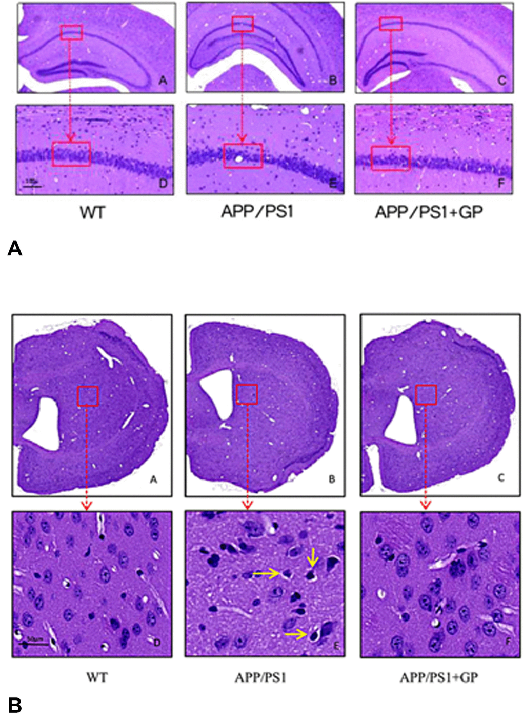 Geniposide ameliorates neuropathological changes in APP/PS1 mice