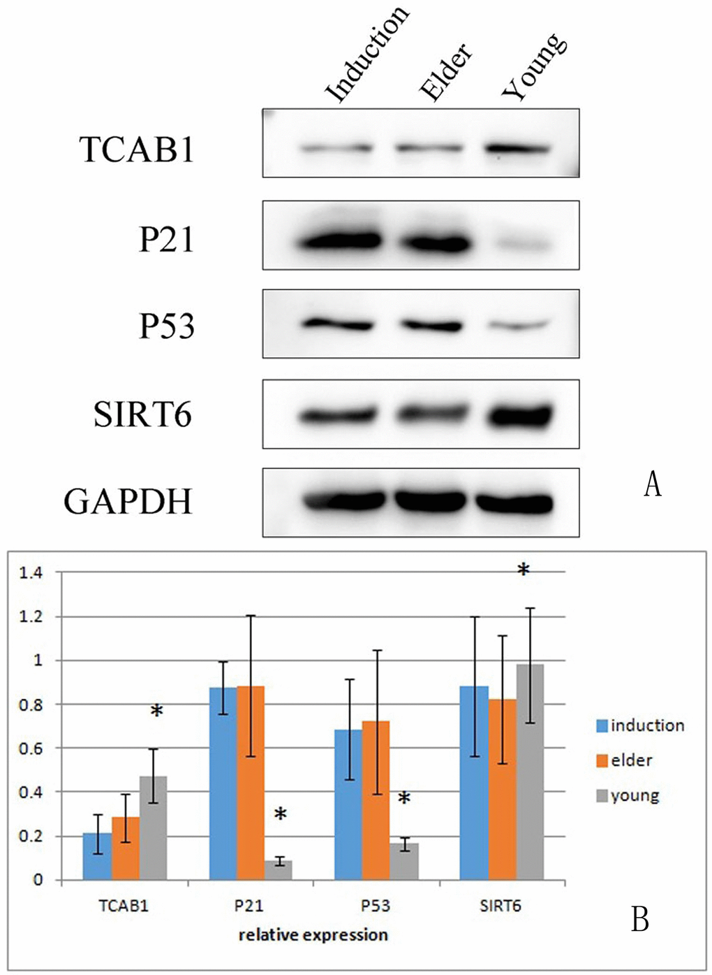 Expression of aging-associated proteins in the young cell group, aged cell group and induced aged BMSC group