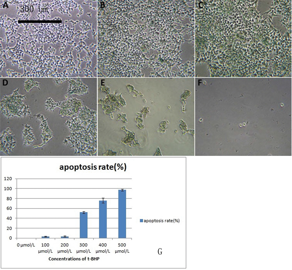 293T cells treated with different concentrations of t-BHP and stained with SA-β-gal (×100)