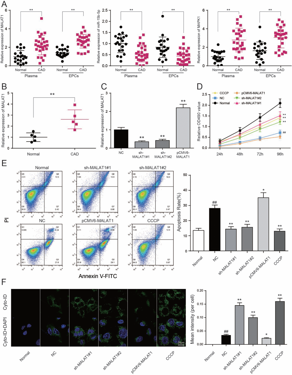 LncRNA MALAT1 inhibits cell autophagy and promotes CAD progression. (A) MALAT1 and MAPK1 were overexpressed in CAD blood samples and EPCs while miR-15b-5p was down-regulated in CAD blood samples and EPCs. **PB) MALAT1 expression in 5 CAD EPC samples was higher than that in 5 healthy EPC samples. **PC) MALAT1 was depressed in EPCs transfected with sh-MALAT1#1 or sh-MALAT1#2 detected by qRT-PCR. **PD) MTT results showed that cell viability was promoted in EPCs transfected with sh-MALAT1#1 or sh-MALAT1#2. **PPE) FCM results revealed that sh-MALAT1#1 or sh-MALAT1#2 restrained cell apoptosis rate of EPCs and there was significant difference between normal group and NC group. *PPPF) Autophagy assay results revealed that sh-MALAT1#1, sh-MALAT1#2 and CCCP raised EPCs autophagy rate and there was conspicuous difference between normal group and NC group. *PPP