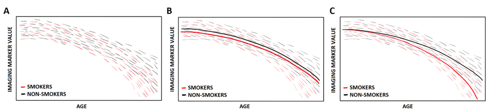 Fictional subject-specific trajectories of an imaging marker in aging, from smokers and non-smokers (A), with population-based trajectories assuming that every subject follows the same trajectory only allowing for a different starting point (B) and population-based trajectories with smoking as an effect modifier (C).