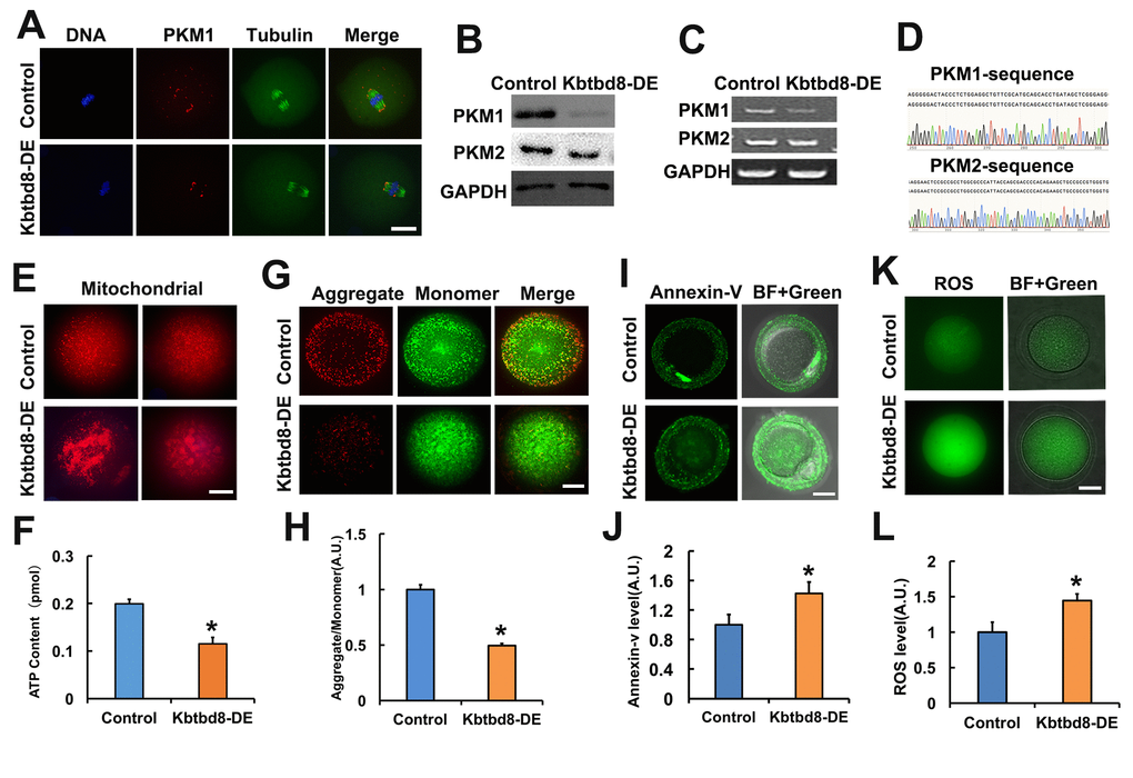 KBTBD8 regulates PKM1 levels and is essential for oocyte quality. A. Representative images of PKM1 and tubulin immunofluorescence in control and KBTBD8-depleted oocytes. Both cytoplasmic and spindle pole PKM1 signals decreased after KBTBD8-depletion. B. PKM1 and PKM2 expression in control and KBTBD8-depleted (KBTBD8-DE) oocytes. GAPDH was used as a loading control. C. RT-PCR assessment of PKM1 and PKM2 mRNAs. GAPDH was used as control. D. DNA sequencing verified that the bands in (C) are PKM1 and PKM2. E. Mitochondrial staining (MitoTracker Red) in control and KBTBD8-depleted oocytes. F. Cytoplasmic ATP contents in control and KBTBD8-depleted oocytes. G. Mitochondrial membrane potential (JC1 staining) in control and KBTBD8-depleted oocytes. H. Quantification of JC1 aggregate/monomer ratios. I. Apoptosis detection (Annexin V staining) in control and KBTBD8-depleted oocytes. Apoptosis increased significantly after KBTBD8 depletion. J. Quantification of Annexin V signal. K. ROS generation in control and KBTBD8-depleted oocytes. L. ROS quantification. Scale bars, 20 µm. * p ˂ 0.05.