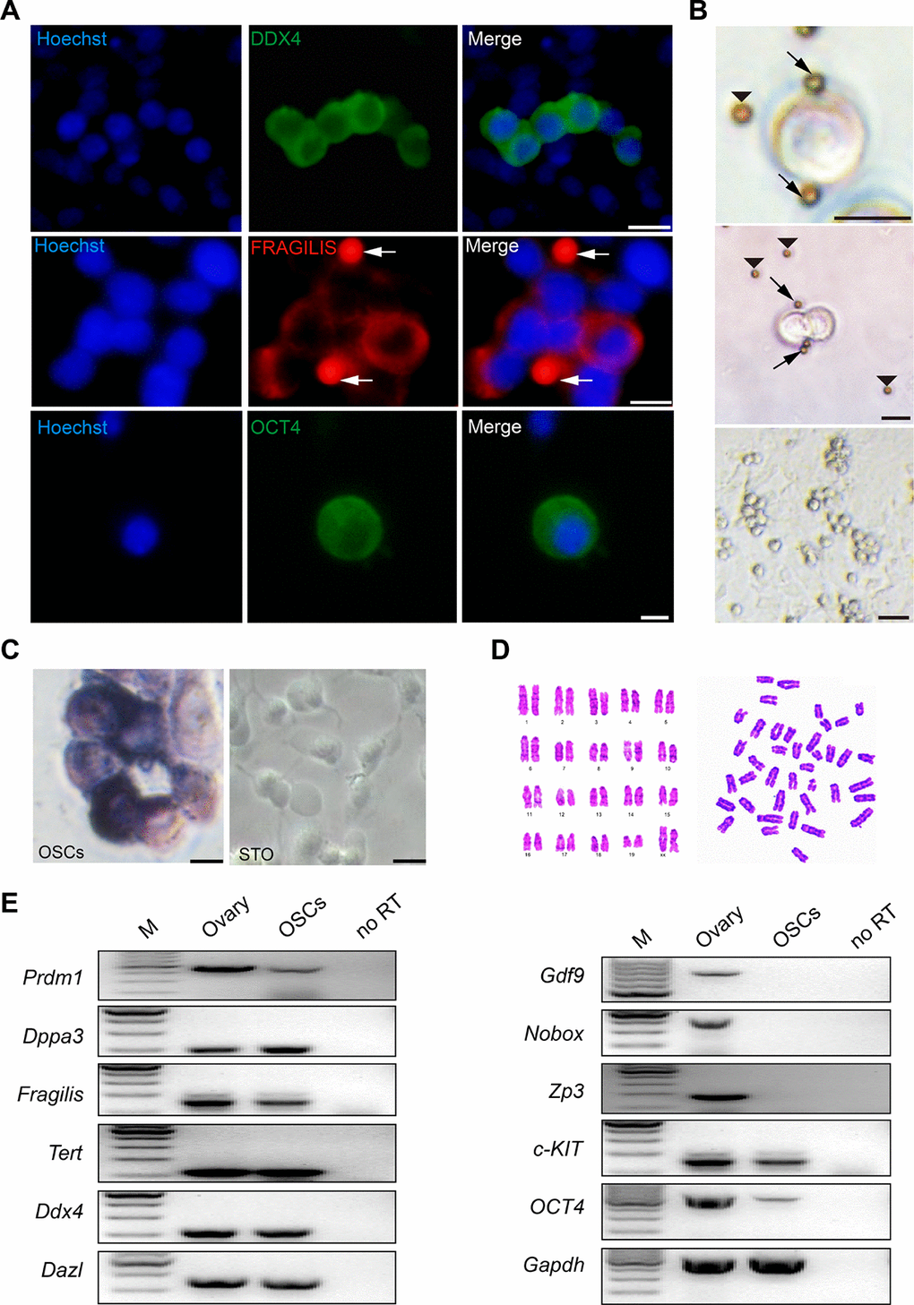 Morphology and characteristics of OSCs. (A) Immunofluorescence of DDX4 (green), FRAGILIS (red) and OCT4 (green) in mOSCs. Arrows: magnetic beads. Scale bars, 10 μm. (B) Examples of OSCs isolated with the Fragilis antibody and the associated pattern of OSCs with immunomagnetic beads. Arrows: magnetic beads associated with OSCs. Arrowheads: free beads. Scale bars, 10 μm, 10 μm, and 25 μm (From top to bottom). (C) Alkaline phosphatase staining for OSCs and STO. Scale bars, 10 μm. (D) Cytogenetic analysis showed that OSCs possessed a normal karyotype (40, XX). (E) Reverse transcription PCR analysis for the expression profile of OSCs using ovarian tissue as a positive control. M: 100 bp DNA marker; No RT, PCR of RNA sample without reverse transcriptase.