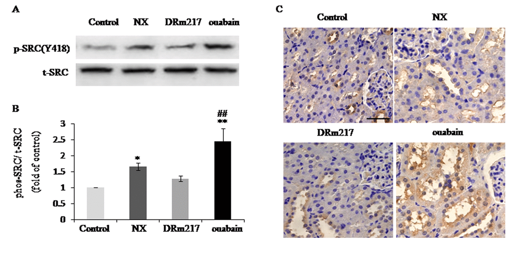 DRm217 blocks Src activation in kidney of 5/6 nephrectomized rats. (A) Representative western blots for Src(Y418) phosphorylation. (B) Quantitative analysis for Src(Y418) phosphorylation. (C) Immunohistochemical analysis of phosphorylated Src in renal tissues. n=6-8. Means±SEM; * p, **ppp