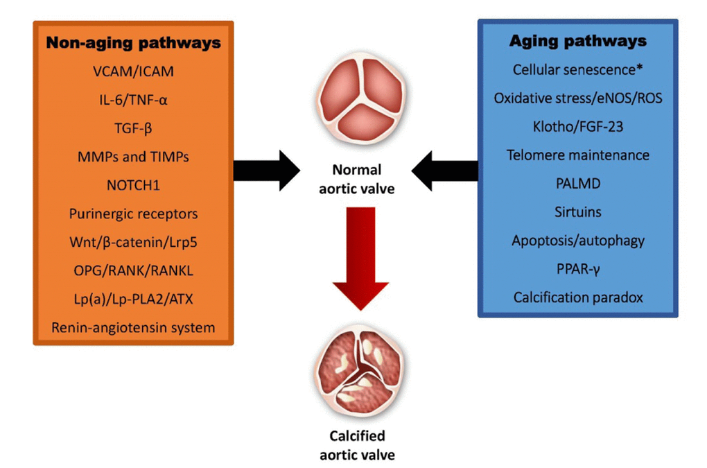 Non-aging and aging pathways involved in calcified aortic stenosis. VCAM: vascular cell adhesion protein; ICAM: intercellular adhesion molecule; IL-6: interleukin-6; TNF-α: tumor necrosis factor alpha; TGF-β: transforming growth factor beta; MMPs: matrixmetalloproteinases; TIMPs: tissue inhibitor of metalloproteinases; Lrp5: low-density lipoprotein receptor-related protein 5; OPG: osteoprotegerin: RANK: receptor activator of nuclear factor kappa-B; RANKL: receptor activator of nuclear factor kappa-B ligand; Lp(a): lipoprotein(a); Lp-PLA2: lipoprotein-associated phospholipase A2; ATX: ataxin; eNOS; endothelial nitric oxide synthase; ROS: reactive oxygen species; FGF-23: fibroblast growth factor 23; PALMD: palmdelphin; PPAR-γ: peroxisome proliferator-activated repector gamma