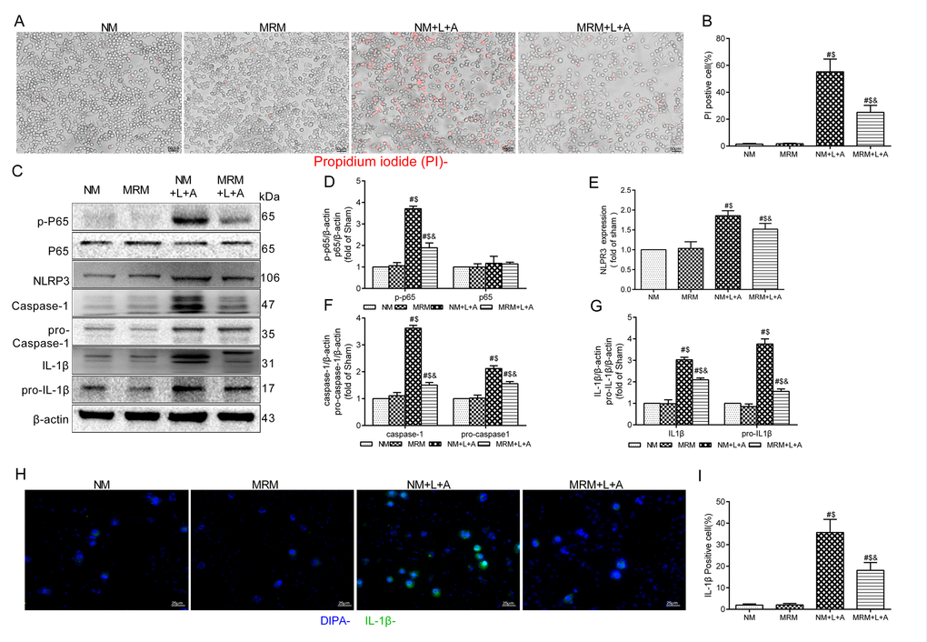  Figure 7. Methane restrained pyroptosis in vitro. (A) Representative propidium iodide (PI) staining of RAW 264.7 cells (Scale bars: 25μm). (B) The percentage of PI positive cells. (C) Representative immunoblots of p65, p-p65, pro-caspase1, pro-IL-1β and NLRP3/Caspase-1/IL-1βfrom RAW264.7 cells. (D) Relative densities of p-P65 and P65, (E) NLRP3, (F) caspase-1 and pro-Caspase-1, and (G) IL-1β and pro-IL-1β were calculated. (H) Representative immunofluorescence staining of IL-1β (Scale bars: 25μm). (I) The percentage of IL-1β positive cells was calculated. (n = 3. Data are shown as the mean ±SD. #P  $p &P 