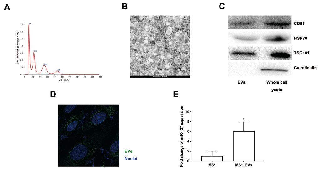 Characteristics of EVs collected from the medium of MIN6 cells. (A) Nanoparticle tracking analysis displayed the size distribution and concentration of particles isolated from MIN6 cells. (B) EVs were observed by transmission electron microscopy. Scale bar, 200 nm. (C) Western blot analysis of exosomal markers in isolated particles and whole MIN6 cell lysates. (D) Uptake of EVs in MS1 cells by confocal microscopy. Blue: DAPI staining; green: PKH67-labeled EVs. (E) The level of miR-127 in MS1 cells was measured after co-culturing with EVs for 24 h by qRT-PCR. The values are presented as the means ± SD. *p