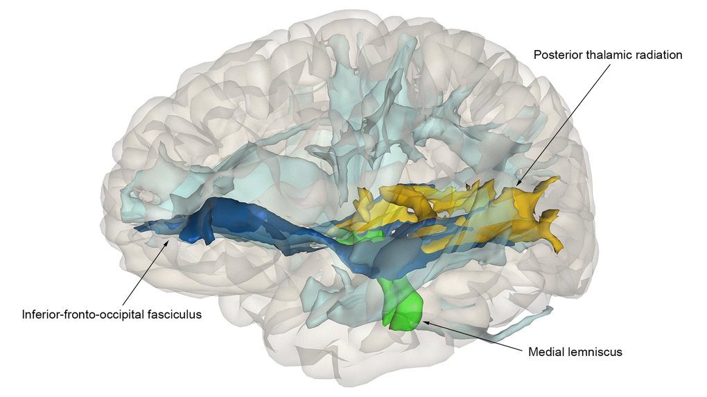 Association of polygenic scores for cognition and tract-specific diffusion-MRI measures. Nominally significant tracts are color-coded: dark-blue – inferior-fronto-occipital fasciculus; green – medial lemniscus; yellow – posterior thalamic radiation. Non-significant tracts are colored in light-blue.