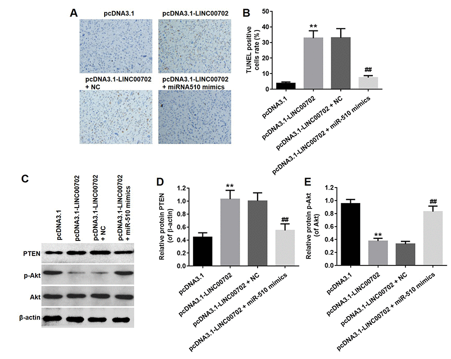 Overexpression of LINC00702 enhanced apoptosis in tumor tissues in vivo. (A) TUNEL analysis of apoptotic cell in the tumor tissues. (B) Quantification of apoptotic cells in (A). (C) Western blotting analysis of the expression levels of PTEN in tumor tissues. (D) Relative PTEN protein level in the experiments shown in (C). (E) Relative p-Akt protein level in the experiments shown in (D). **P##P