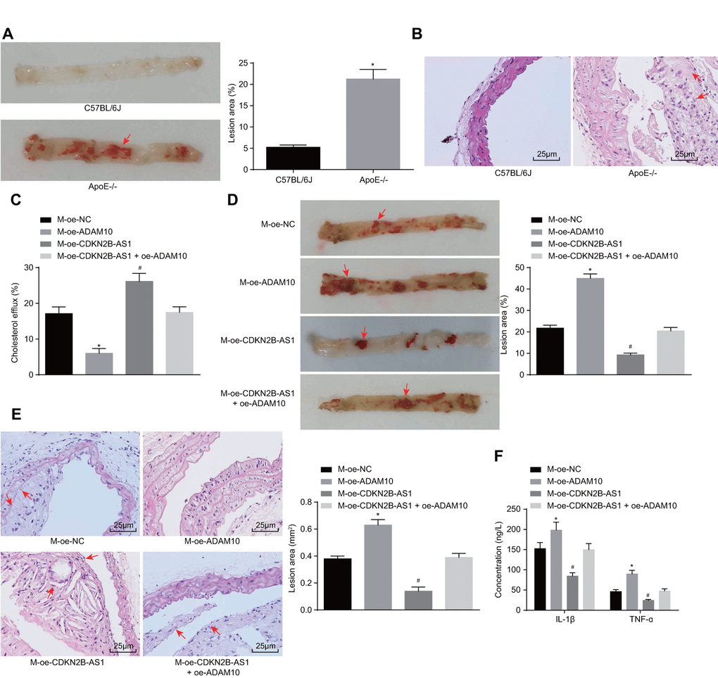 Overexpression of CDKN2B-AS1 methylates ADAM10, inhibits inflammatory response, and promotes cholesterol efflux in atherosclerosis. (A) Oil red O staining of aortic was used to detect aortic plaque formation in C57BL/6J and ApoE-/- mice (× 10), the red arrows indicate the formed atheromatous plaque; (B) HE staining was used to detect arterial plaque formation in C57BL/6J and ApoE-/- mice (× 400), the red arrows indicate atheromatous plaque accompanied by foam cells after HE staining; (C) Liquid scintillation counter was applied to measure the effect of various intervention factors on serum cholesterol efflux in ApoE-/- mice; (D) Oil red O staining of aortic detection of intervention factors of aortic plaque formation on ApoE-/- mice (× 10), the arrows indicate the formed atheromatous plaque; (E) HE staining of aortic roots for detection of aortic plaque formation in ApoE-/- mice (× 400). (F) ELISA was used to detect the serum levels of IL-1β and TNF-ɑ in ApoE-/- mice; * p p t-test, n = 12; the experiment was repeated 3 times; HE, hematoxylin-eosin; ELISA, enzyme linked immunosorbent assay; TNF, tumor necrosis factor; IL, interleukin; CDKN, cell-dependent kinase inhibitor; ADAM10, A disintegrin and metalloprotease 10.