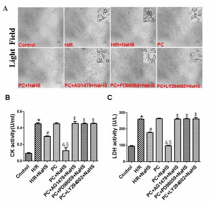 Exogenous H2S decreases cell damage in the aged H9C2 cells. (A) Exogenous H2S decreased cell damage. The cells were cultured in glass-bottom dishes and observed using a general inverted microscope (magnification ×100). (B, C) Exogenous H2S inhibited the activity of LDH (C) and CK (B). The LDH and CK activities were detected in the cell culture fluid. Data are the means ± S.E.M. of 8 determinations. * pvs. control group; # pvs. H/R group; & pvs. PC group; § pvs. H/R + NaHS group; $ pvs. PC + NaHS group.