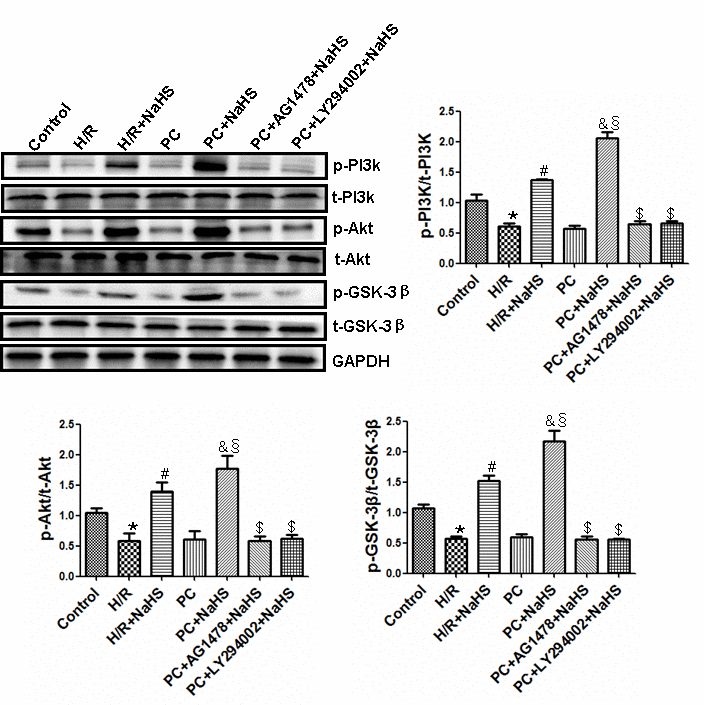 Exogenous H2S activities of the PI3K-Akt-GSK-3β pathway up-regulates the HB-EGF/EGFR pathway in the aged H9C2 cells. The phosphorylation of PI3K, Akt and GSK-3β was detected using western blotting analysis. The graphs represent the optical density of the bands of phospho-PI3K (p- PI3K), Akt (p-Akt) and GSK-3β (p- GSK-3β) normalized to the expression of total-PI3K (t-PI3K), Akt (t-Akt) and GSK-3β (t-GSK-3β). All data were from three independent experiments. * pvs. control group; # pvs. H/R group; & pvs. PC group; § pvs. H/R + NaHS group; $ pvs. PC + NaHS group.
