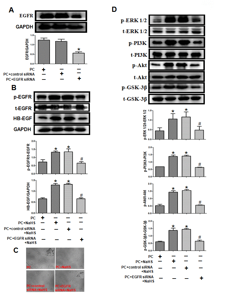 Knockdown of EGFR cancels the effect of exogenous H2S on cell damage and related signaling pathways in the aged H9C2 cells. (A) The knockdown of EGFR by EGFR-specific siRNA (EGFR siRNA) in the aged H9C2 cells. The cells were transfected with 50 nM EGFR siRNA or negative control siRNA (control siRNA) for 48 h during P(C) The data are the means ± S.E.M. of 3 determinations. * pvs. PC + control siRNA group. (B) The knockdown of EGFR inhibited NaHS-increased expression of the HB-EGF and the activity of phosphorylated EGFR. The graphs represent the optical density of the bands of phosphorylated EGFR (p- EGFR) normalized to the expression of total EGFR (t-EGFR). The graphs represent the optical density of the bands of HB-EGF normalized to the expression of GAPDH signal. All data were from three independent experiments. * pvs. PC group; # pvs. PC + control siRNA + NaHS group. (C) The knockdown of EGFR cancelled NaHS-decreased cell damage. The cells were cultured in glass-bottom dishes and observed using a general inverted microscope (magnification ×100). (D) The knockdown of EGFR inhibited NaHS-up-regulated the ERK1/2 and PI3K-Akt-GSK-3β pathways. The phosphorylation of ERK1/2, PI3K, Akt and GSK-3β was detected using western blotting analysis. The graphs represent the optical density of the bands of phospho-ERK1/2 (p-ERK1/2), PI3K (p- PI3K), Akt (p-Akt) and GSK-3β (p-GSK-3β) normalized to the expression of total-ERK1/2 (t-ERK1/2) PI3K (t-PI3K), Akt (t-Akt) and GSK-3β (t-GSK-3β). All data were from three independent experiments. * pvs. PC group; # pvs. PC + control siRNA + NaHS group.