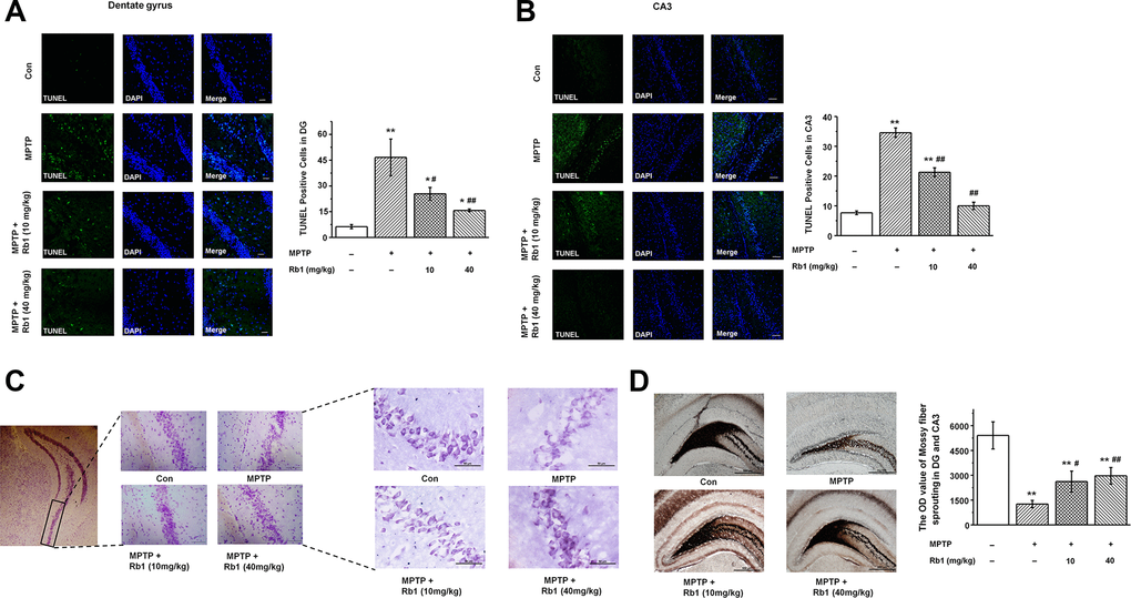 Rb1 protects hippocampal neurons from death in MPTP-treated mice. (A and B) TUNEL staining showed the apoptosis of hippocampal neurons in the DG and CA3 regions. Scale bar, 30 μm in (A) and 60 μm in (B). (C) Nissl staining of hippocampal neurons in the CA3 regions. Scale bar, 100 μm for the low-power field in the left and 50 μm for the high-power field in the right. (D) Timm staining of mossy fiber in the DG and CA3 regions. Scale bar, 500 μm. n = 10 per group. Results are expressed as the mean ± SEM. **p *p ##p #p post hoc comparisons.