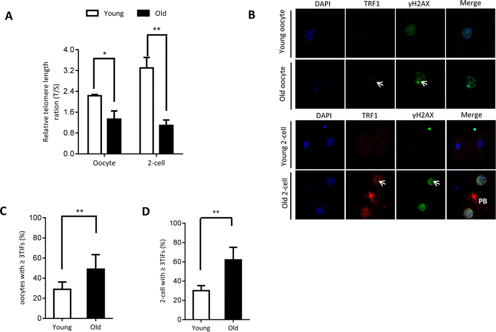 Telomere dysfunction and DNA damage in aged oocytes and embryos. (A) Relative telomere length in oocytes and two-cell embryos is expressed as a T/S ratio determined by quantitative RT-PCR analysis. Data are expressed as mean percentage ± SD of three independent experiments (oocytes: n=114 young, n=106 old; embryos: n=85 young, n=86 old). (B) Representative images of oocytes/two-cell embryos stained with antibodies against TRF1 (red) and γH2AX (green), and co-stained with Hoechst 33342 for chromosomes (blue). PB, polar body. Scale bars, 25 µm. (C–D) Quantification of DNA damage-induced foci (TIFs) from (B). TIFs were detected by co-localization of TRF1 and γ-H2AX, and cells with at least 3 TIFs were scored. Data represent averages of 3–10 fields. Error bars indicate SD (oocytes: n=24 young, n=26 old; embryos: n=35 young, n=38 old). Statistical analyses were performed with Student’s t-test. *P 