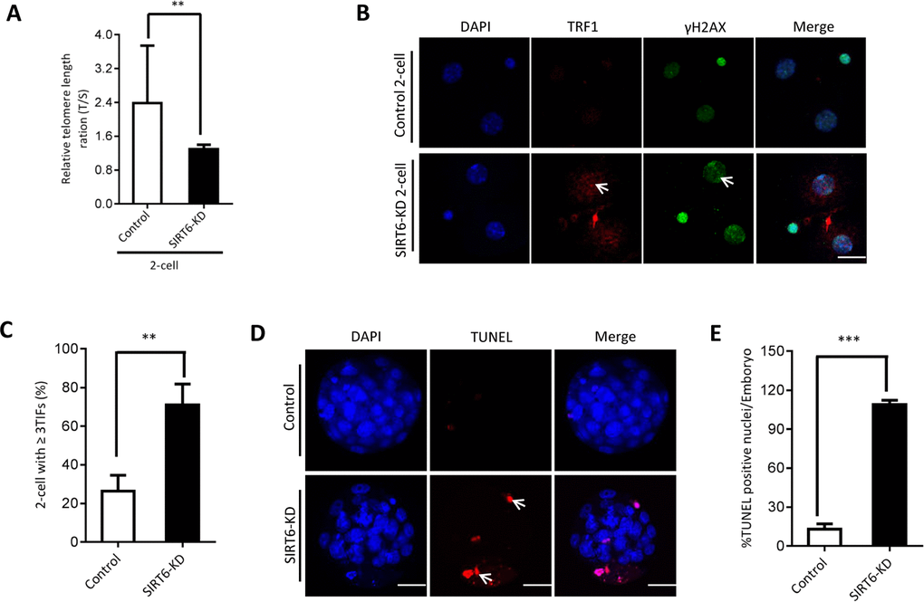 SIRT6 knockdown in oocytes induces DNA damage and apoptosis of early embryos. (A) Relative telomere length in two-cell embryos is expressed as a T/S ratio determined by quantitative RT-PCR analysis. Data are expressed as mean percentage ± SD of three independent experiments (n=125 for control; n=128 for SIRT6-KD). (B) Representative images of young and SIRT6-KD two-cell embryos stained with antibodies against TRF1 (red) and γH2AX (green), and co-stained with Hoechst 33342 for chromosomes (blue). Scale bars, 25 µm. (C) Quantification of DNA damage-induced foci (TIFs) from (B). TIFs were detected by co-localization of TRF1 and γ-H2AX, and cells with at least 3 TIFs were scored (n=35 for control; n=32 for SIRT6-KD). Data represent averages of 3–10 fields. (D) TUNEL analysis of control and SIRT6-KD embryos. Embryos were labeled with Hoechst 33342 (blue) for DNA and by TUNEL for fragmented DNA (red). Arrowheads point to the apoptotic cells in blastocysts. (E) Quantification of control and SIRT6-KD blastocysts with TUNEL positive nuclei (n=82 for control; n=75 for SIRT6-KD). Statistical analyses were performed with Student’s t-test. *P