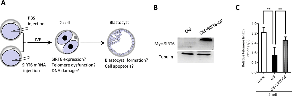 SIRT6 overexpression in aged oocytes increases the telomere length in early embryos. (A) Schematic presentation of the SIRT6 overexpression experiments. (B) Efficiency of SIRT6 overexpression (SIRT6-OE) after mRNA injection was verified by immunoblotting. (C) Relative telomere length expressed in two-cell embryos is expressed as a T/S ratio determined by quantitative RT-PCR analysis. Data are expressed as mean percentage ± SD of three independent experiments (n=86 for young; n=85 for old; n=80 for old+SIRT6-OE). **P 