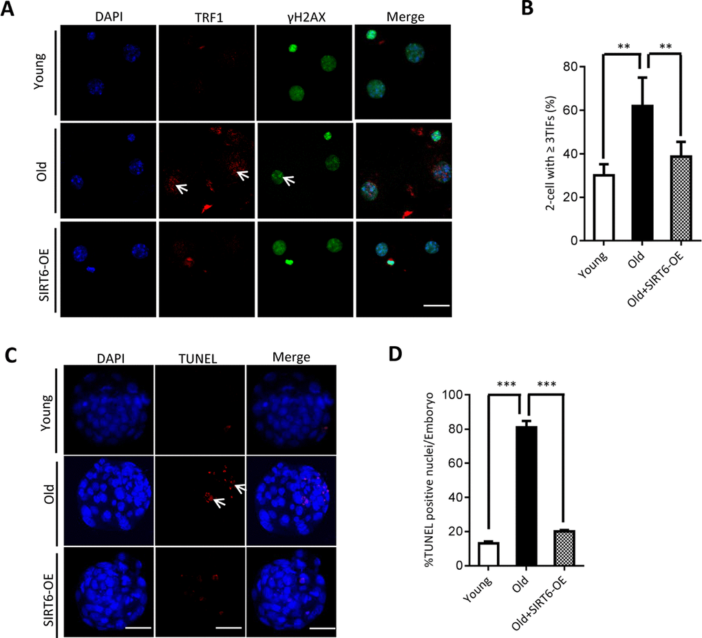 SIRT6 overexpression in aged oocytes partly prevented the defective phenotype of early embryos. (A) Representative images of young, old, and SIRT6-OE two-cell embryos stained with antibodies against TRF1 (red) and γH2AX (green), and co-stained with Hoechst 33342 for chromosomes (blue). Scale bars, 25 µm. (B) Quantification of DNA damage-induced foci (TIFs) from (A). TIFs were detected by co-localization of TRF1 and γ-H2AX, and cells with at least 3 TIFs were scored (n=26 for young; n=28 for old; n=25 for old+SIRT6-OE). (C) TUNEL analysis of young, old, and SIRT6-OE embryos. Embryos were labeled with Hoechst 33342 (blue) for DNA and by TUNEL for fragmented DNA (red). Arrowheads point to the apoptotic cells in blastocysts. Scale bars, 25 μm. (D) Quantification of young (n=90), old (n=82), and SIRT6-OE (n=78) blastocysts with TUNEL positive nuclei. Data are expressed as mean percentage ± SD from three independent experiments. ** P