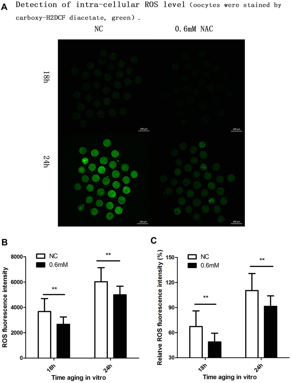 Supplementation of NAC decreases the intra-cellular ROS level. (A) Representative images of carboxy-H2DCF fluorescence in oocytes. Images were analyzed by a Perkin Elmer precisely Ultra VIEW VOX Confocal Imaging System with the identical fluorescence parameters. NC, control group in which oocytes were not treated with NAC. 0.6mM NAC, oocytes treated with 0.6mM NAC. 18h, 24h: timing of aging in vitro. (B) Quantitative analysis (counts of photons for each oocyte) of fluorescence intensity. The fluorescence intensity analysis for each oocyte was conducted using ZEN (2012) software. NC, control group in which oocytes were not treated with NAC. 0.6mM, oocytes treated with 0.6mM NAC. Double star represents mean difference, p C) ROS relative fluorescent intensity in oocytes. The fluorescence intensity of oocytes which were cultured for 24h in the control group, was set as 100%. The y-axis represents the percentage of fluorescence intensity for each group compared to the group which was set as 100%. NC, control group in which oocytes were not treated with NAC. 0.6mM NAC, oocytes treated with 0.6mM NAC. Double star represents mean difference, p 